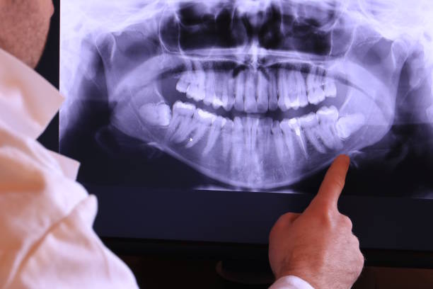 Best 24-Hour Emergency Dentist in Iona, FL