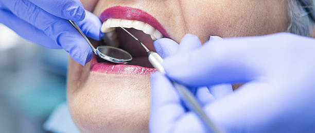 Best Walk-In Emergency Dentist in Iona, FL