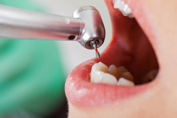 Best Emergency Orthodontic Repairs in Iona, FL